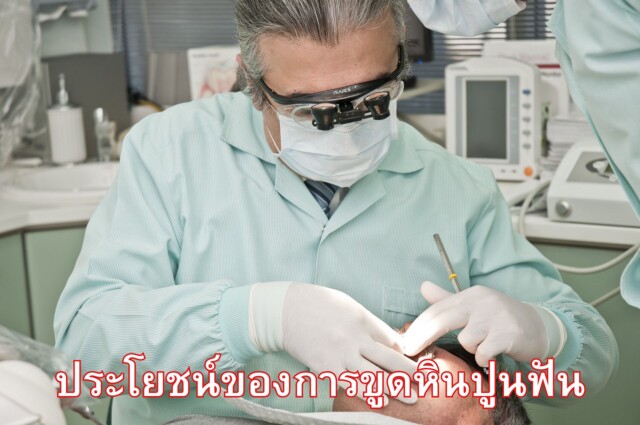 ประโยชน์ของการขูดหินปูนฟัน