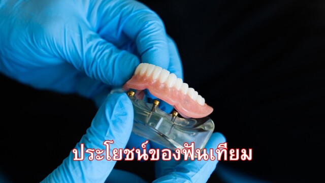 ประโยชน์ของฟันเทียม