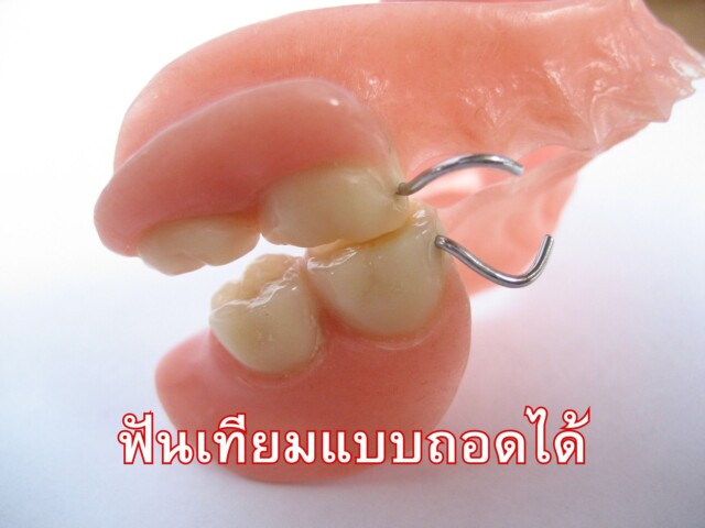 ประโยชน์ของฟันเทียม